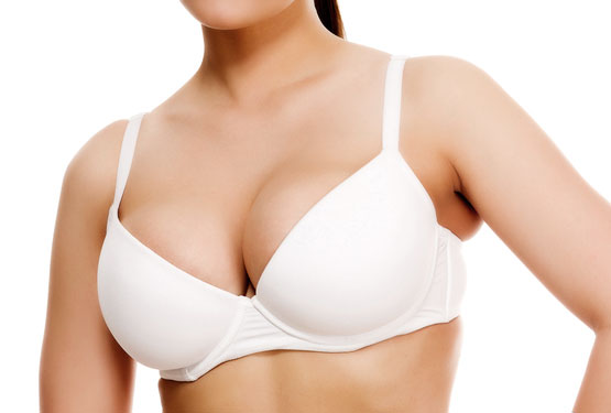 Breast Augmentation Surgery in Ocala, FL.